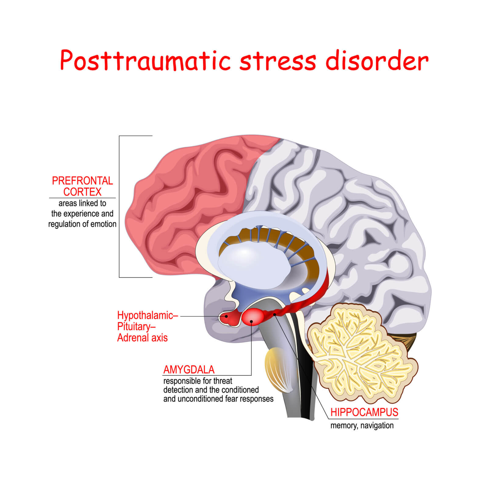 Hypnotherapy For Ptsd Why Consider It Hemisphere Hypnotherapy